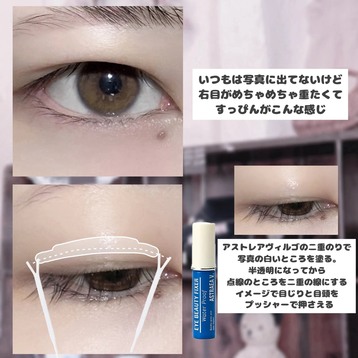 アイビューティー フィクサー WP/アストレア ヴィルゴ/二重まぶた用アイテムを使ったクチコミ(3枚目)