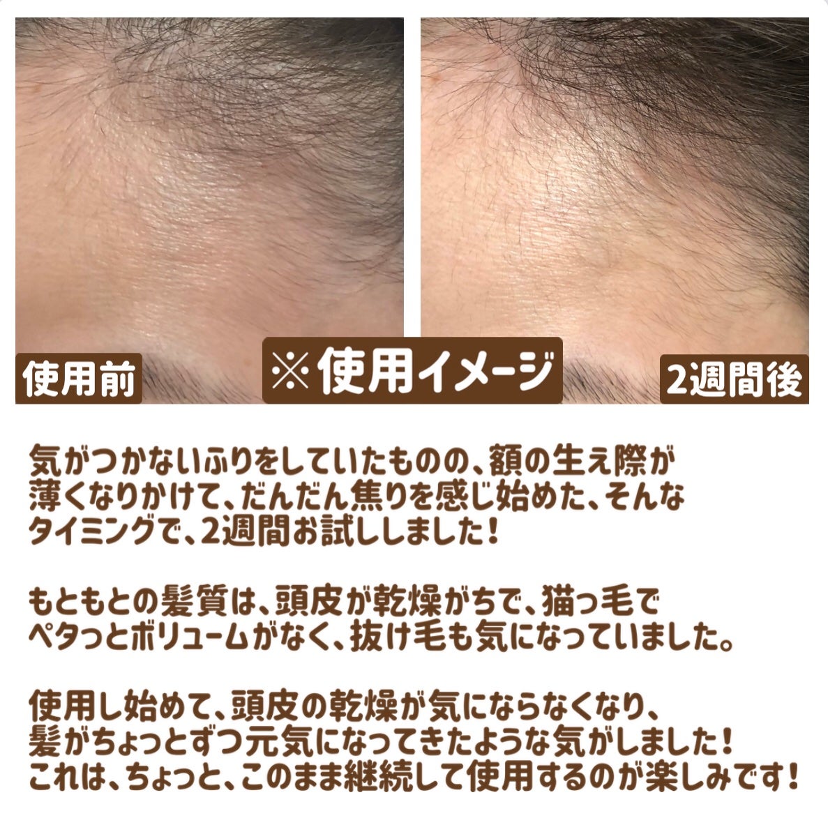 VT PDRN リードルショット ヘアアンプル700dL/VT/頭皮トリートメントを使ったクチコミ(3枚目)