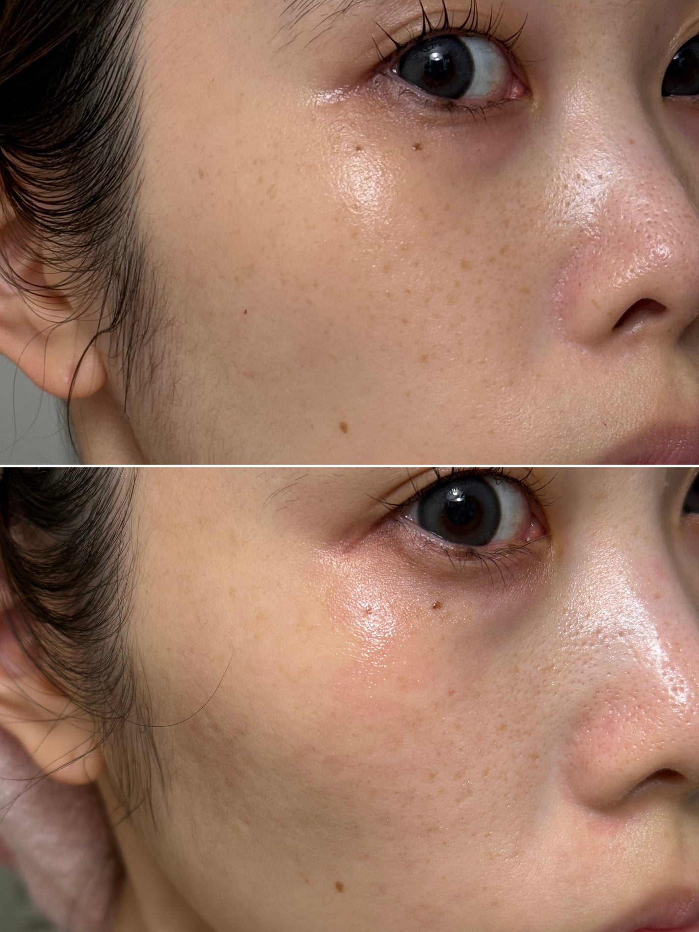 TXトーニングクリーム/VT/フェイスクリームを使ったクチコミ(2枚目)