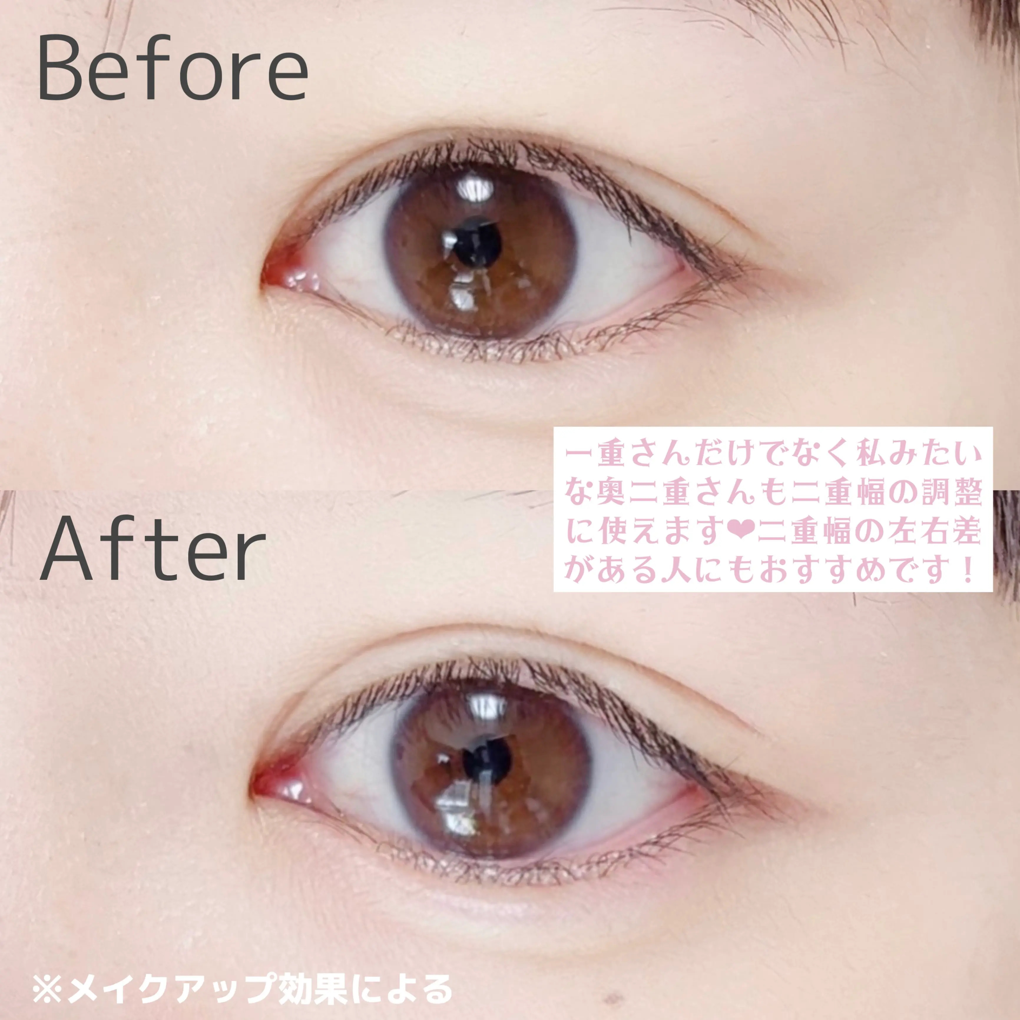 アイビューティー フィクサー WP/アストレア ヴィルゴ/二重まぶた用アイテムを使ったクチコミ（3枚目）