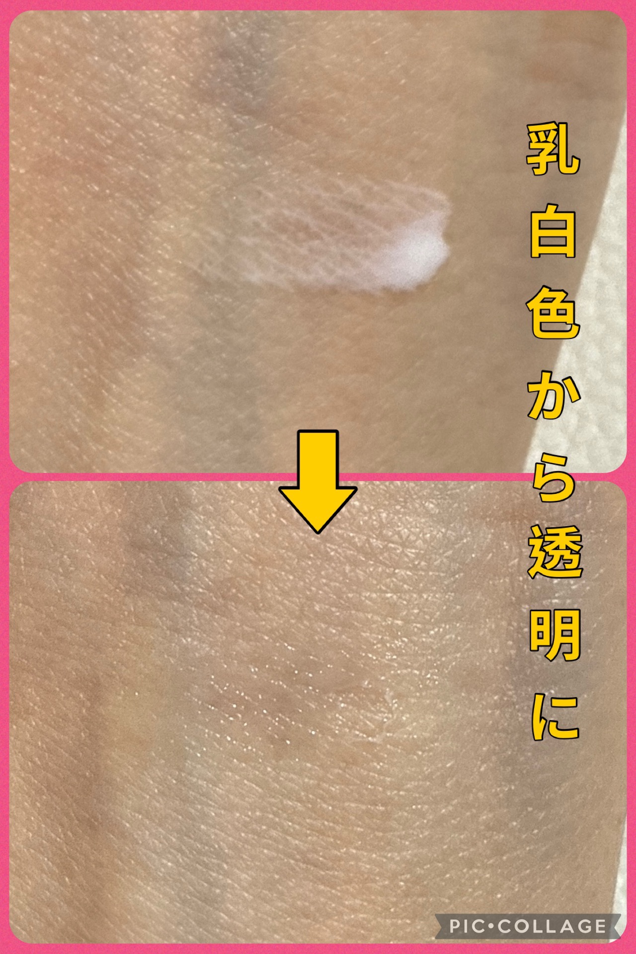 アイビューティー フィクサー WP/アストレア ヴィルゴ/二重まぶた用アイテムを使ったクチコミ（3枚目）