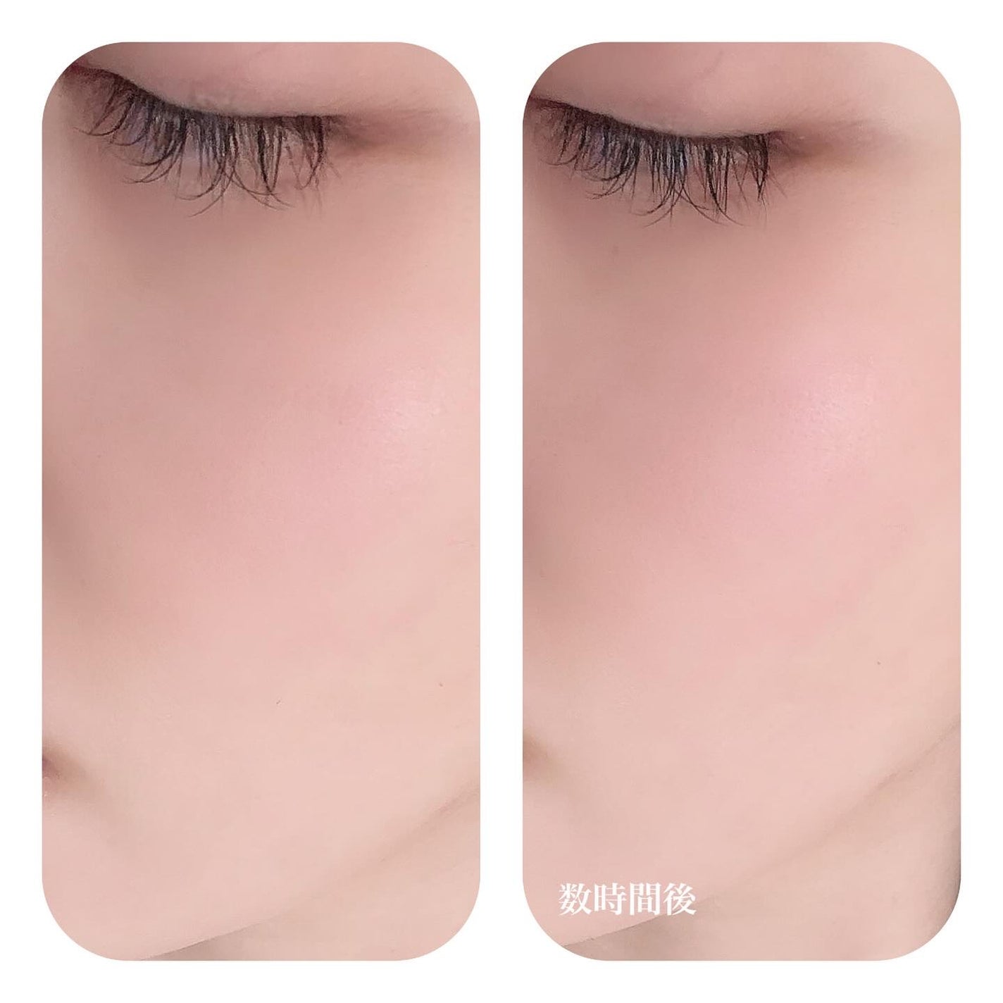 LENA on LIPS 「.LemonSquareを通じて、K.LUPCO.,Ltd.か..」(5枚目)