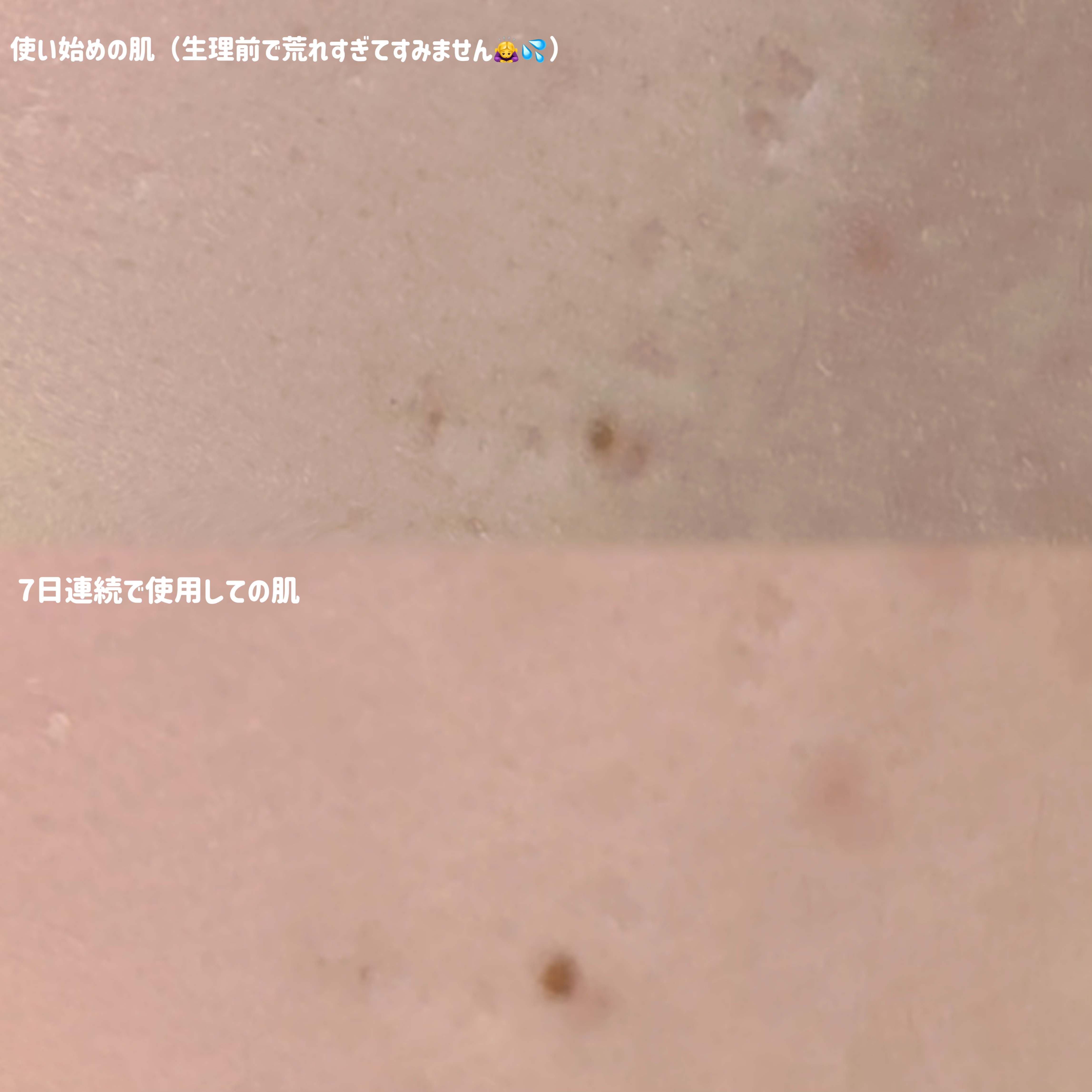 リアルブルーセンテラ アズレン エッセンス化粧水/Mildlab/化粧水を使ったクチコミ（3枚目）