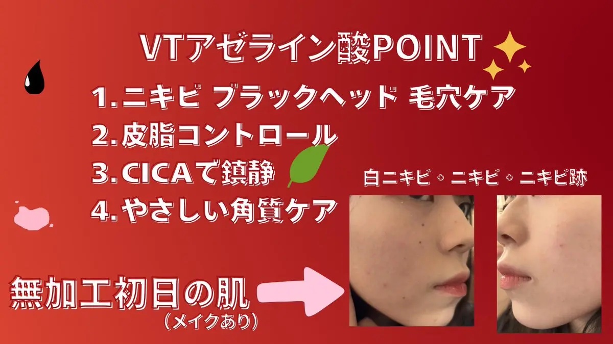 レッドブースター リードルショット100/VT/ブースター・導入液を使ったクチコミ（2枚目）