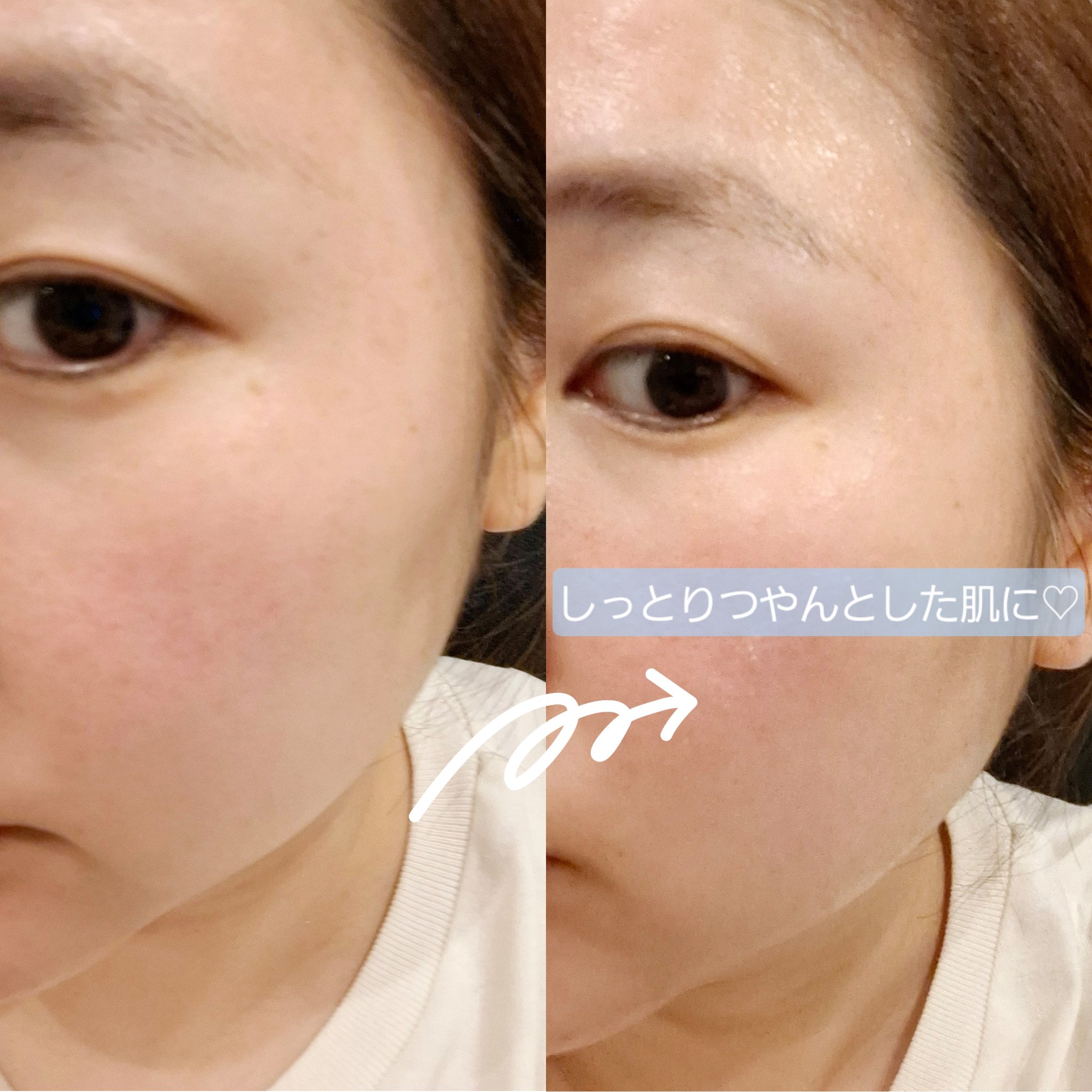 ライス グロウ フォームトナー/FABYOU/化粧水を使ったクチコミ（3枚目）