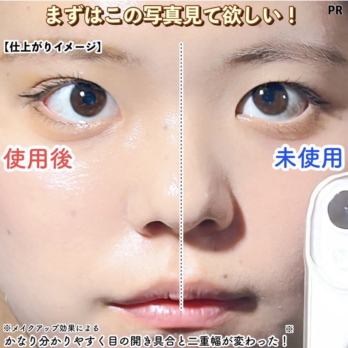 アイビューティー フィクサー WP/アストレア ヴィルゴ/二重まぶた用アイテムを使ったクチコミ（2枚目）