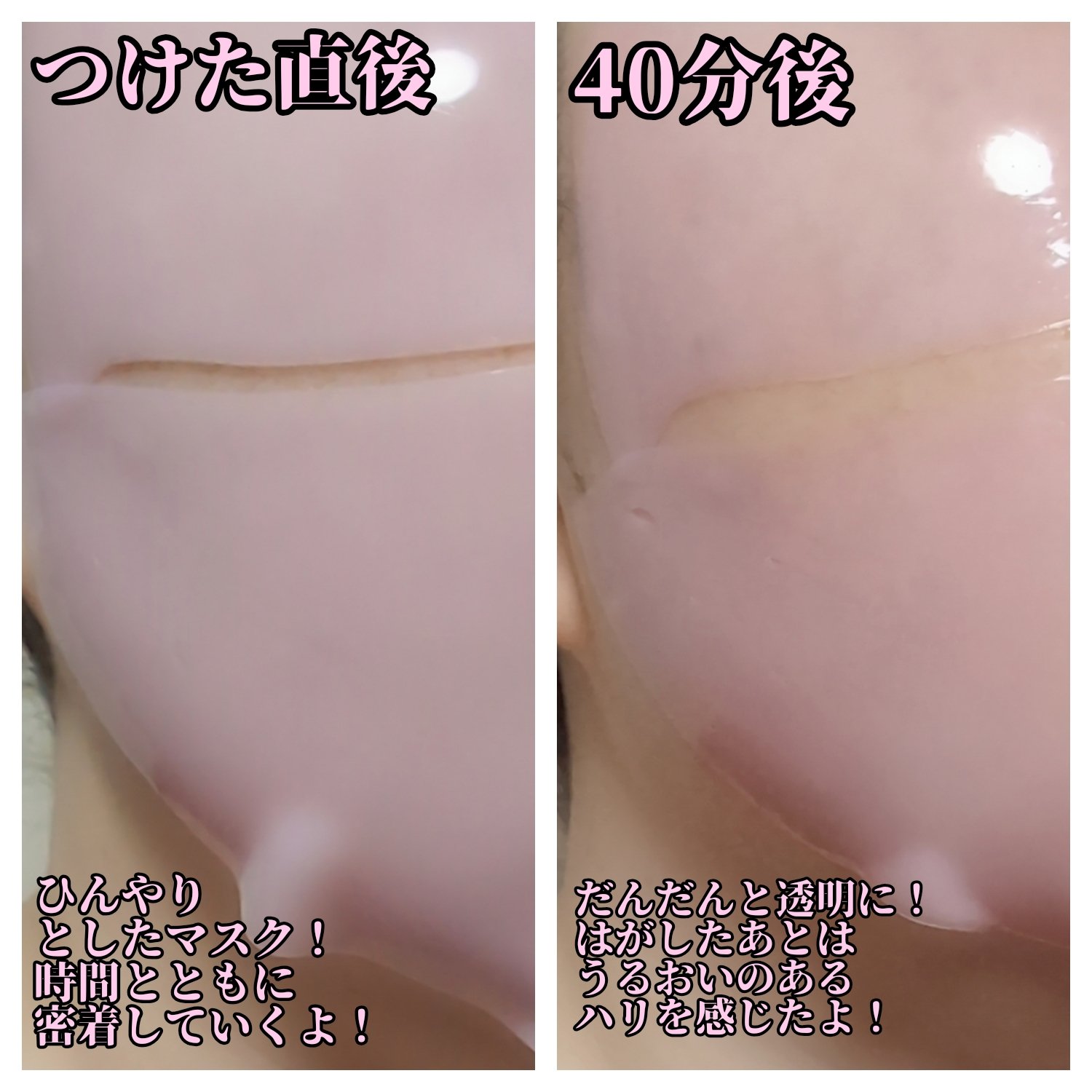 PDRNピンクコラーゲンゲルマスク/MEDICUBE/シートマスク・パックを使ったクチコミ（2枚目）