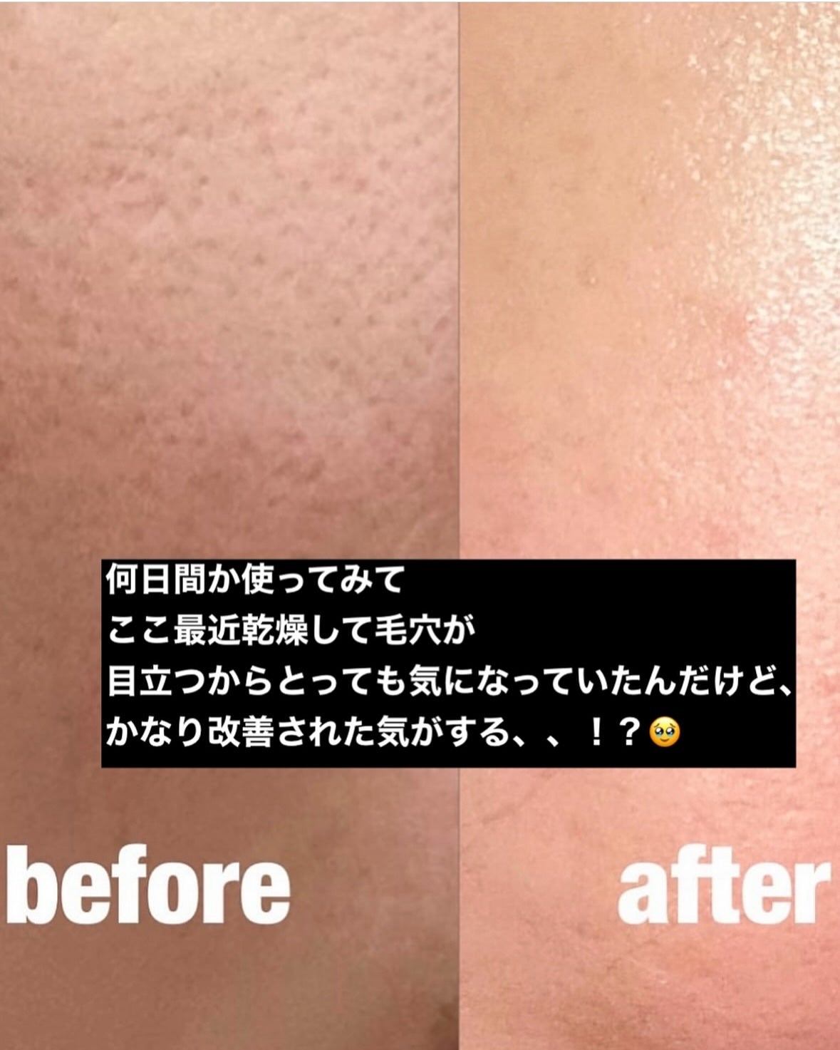 レッドブレミッシュ クリアスージングクリーム/Dr.G/フェイスクリームを使ったクチコミ(4枚目)