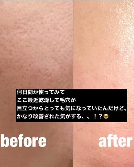 レッドブレミッシュ クリアスージングクリーム/Dr.G/フェイスクリームを使ったクチコミ(4枚目)