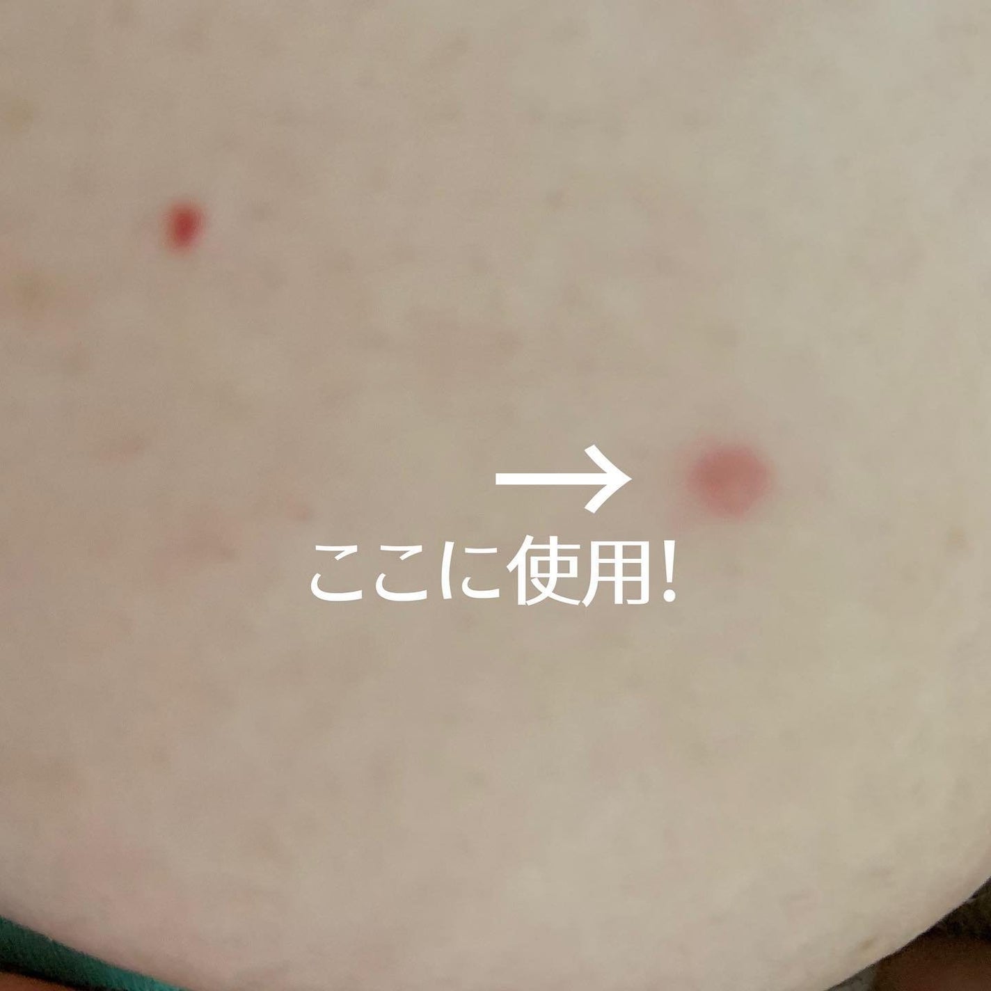 マジックティーツリーオイル/ブラン/フェイスオイルを使ったクチコミ(6枚目)