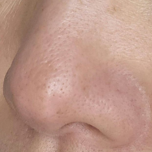 AZケア トナーパッド/VT/トナーパッドを使ったクチコミ（3枚目）