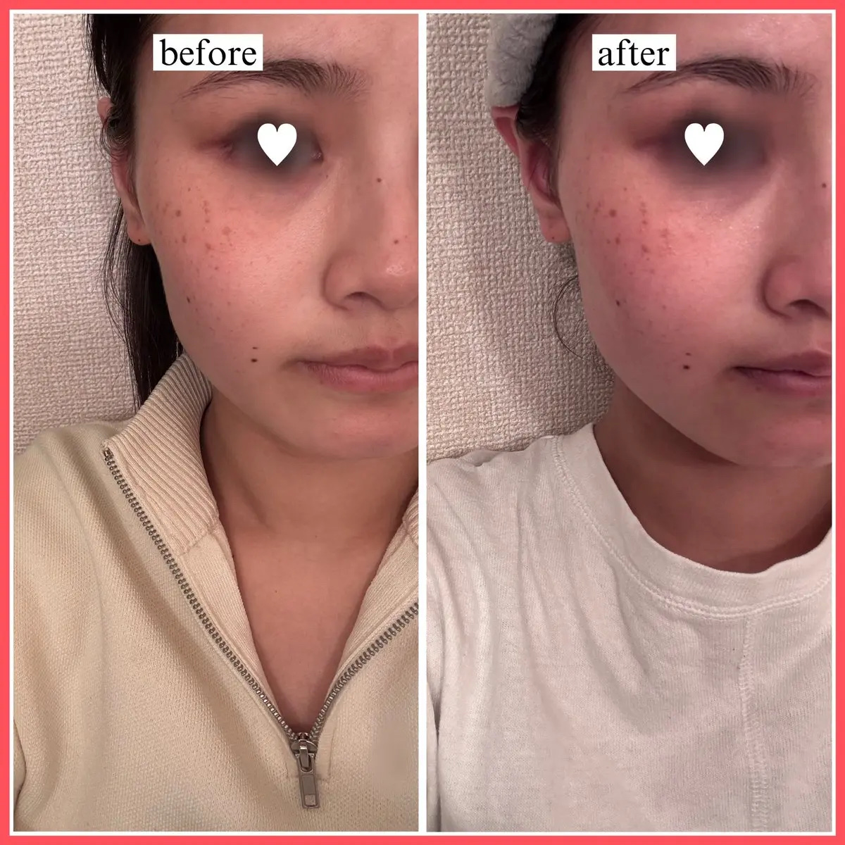 A1カーミング アンプル/VT/美容液を使ったクチコミ（3枚目）