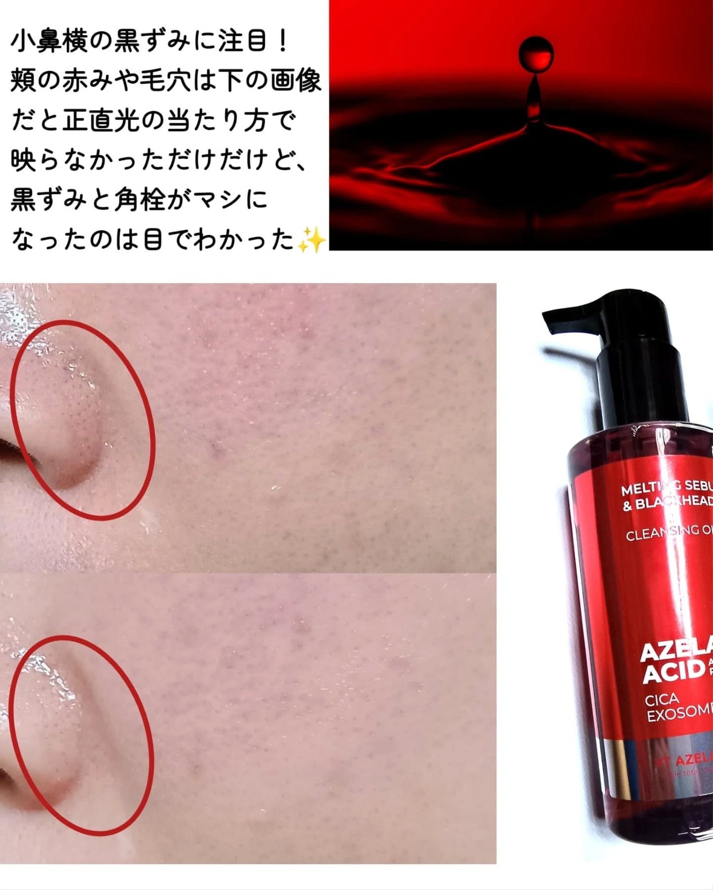 レッドブースター リードルショット100/VT/ブースター・導入液を使ったクチコミ(5枚目)