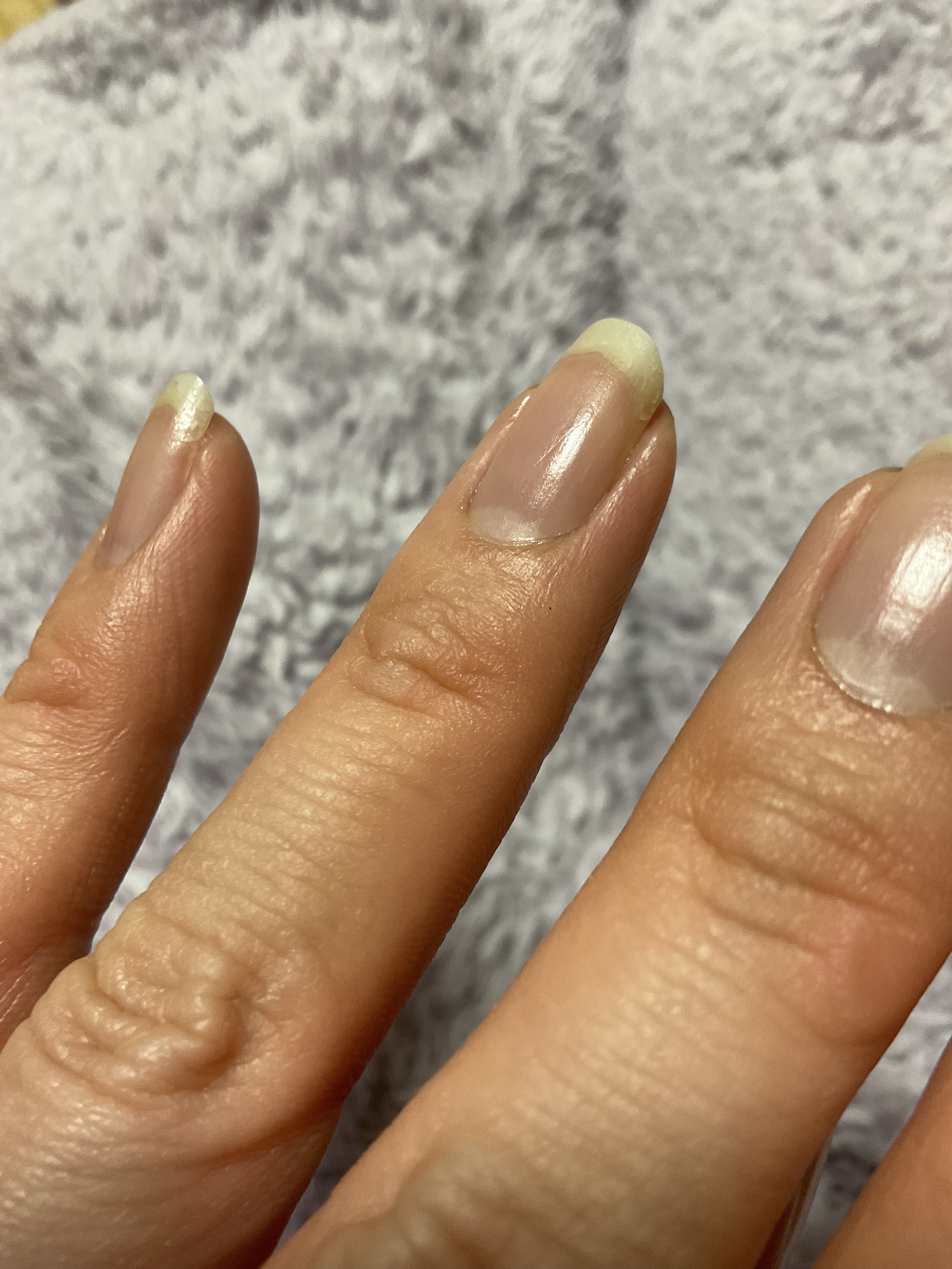 エテュセ クイックケアコート/ettusais/ネイルオイル・トリートメントを使ったクチコミ（2枚目）