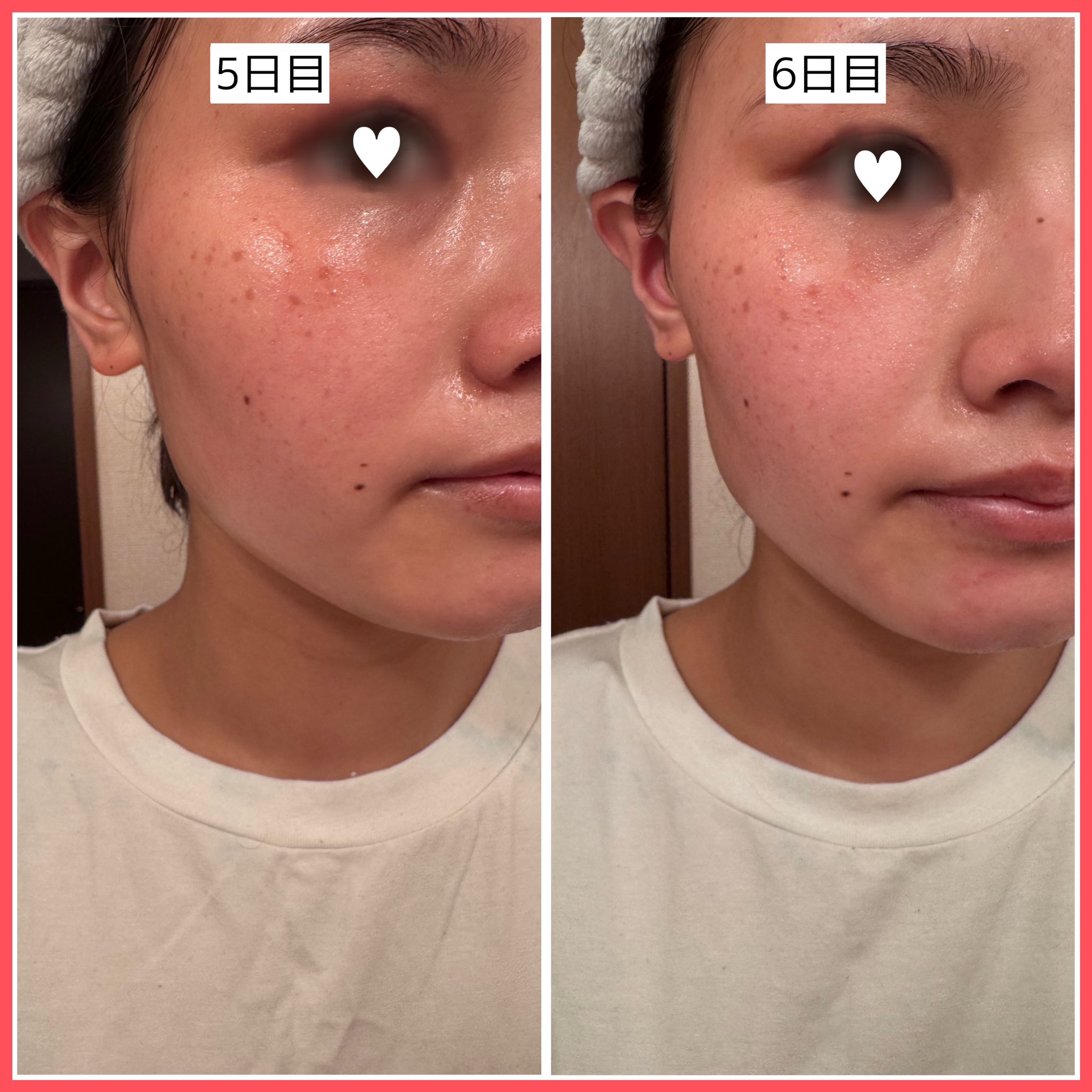 レッドブースター リードルショット100/VT/ブースター・導入液を使ったクチコミ（3枚目）