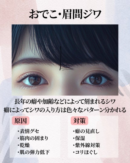 もぐお on LIPS 「ほんとうに恐ろしい顔のシワ図鑑/顔のシワって深さによっても原因..」(8枚目)