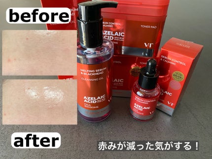 A1カーミング アンプル/VT/美容液を使ったクチコミ(5枚目)