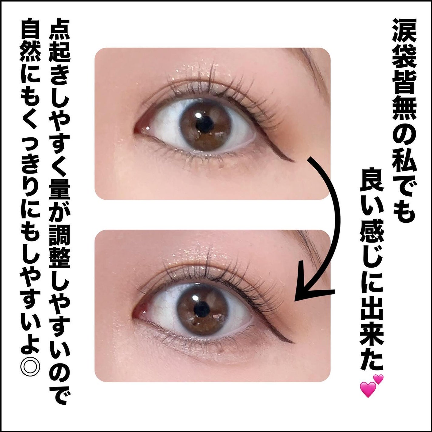 キス スキニー リキッドコンシーラーX /KiSS/リキッドコンシーラーを使ったクチコミ(5枚目)