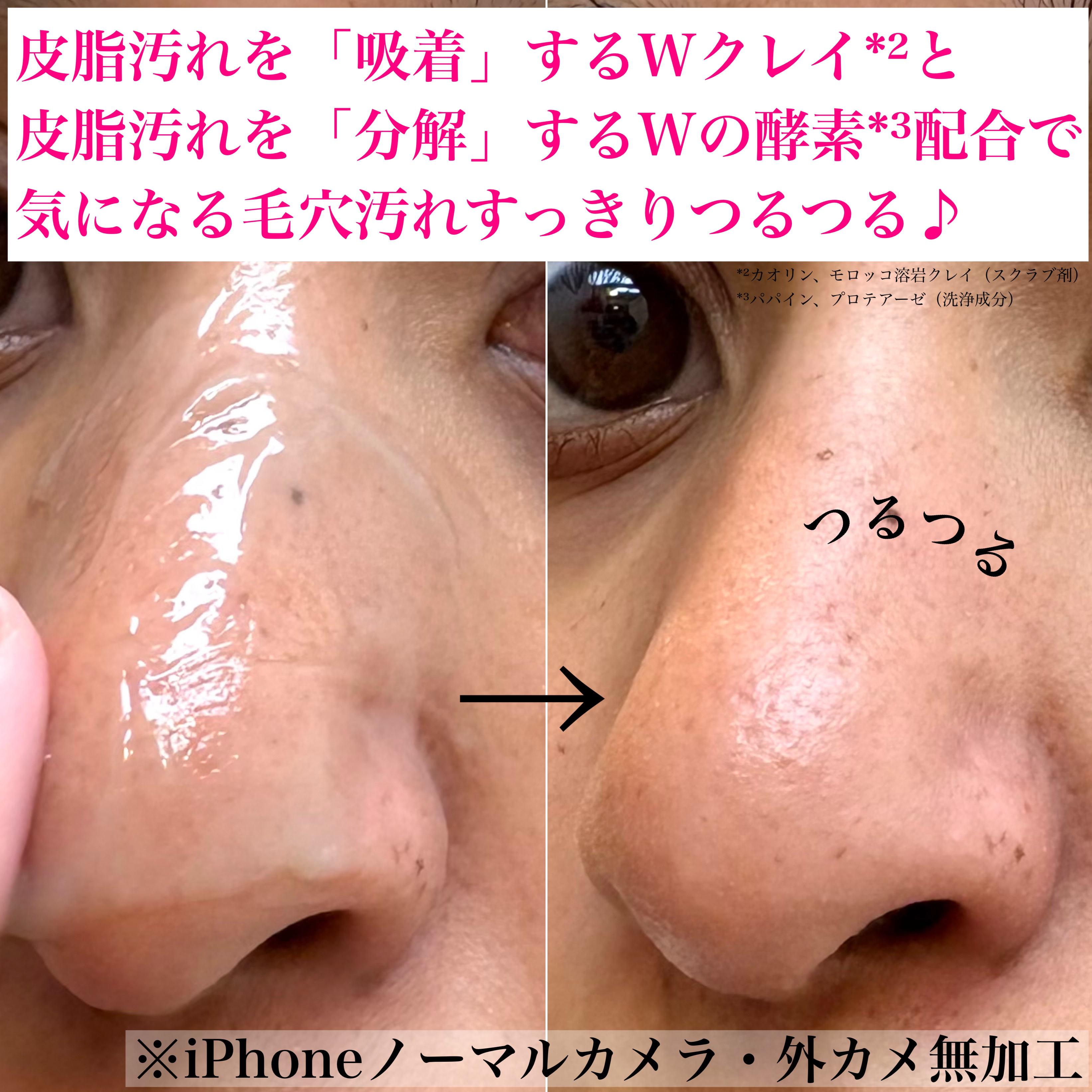 毛穴フォーカスVC VC3シートマスク/pdc/シートマスク・パックを使ったクチコミ（2枚目）