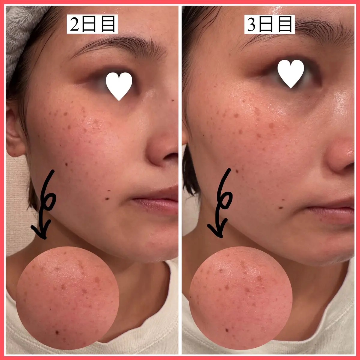 を使ったクチコミ（2枚目）