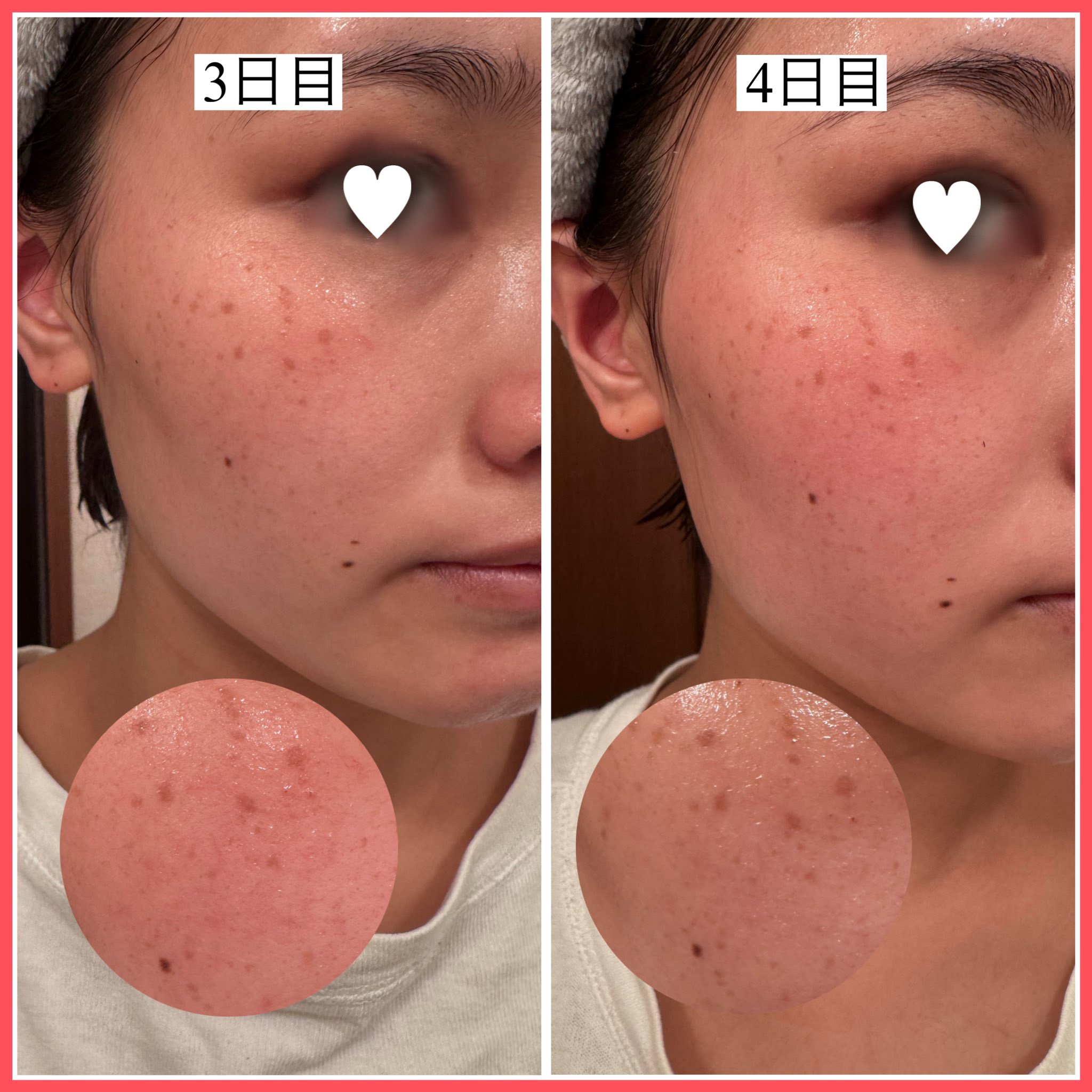 AZケア クレンジングオイル/VT/オイルクレンジングを使ったクチコミ（3枚目）