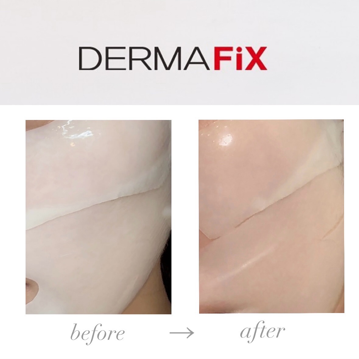 パーフェクト リアル パフォーマンス シカコラーゲンマスクパック /ダーマフィックス/シートマスク・パックを使ったクチコミ（3枚目）