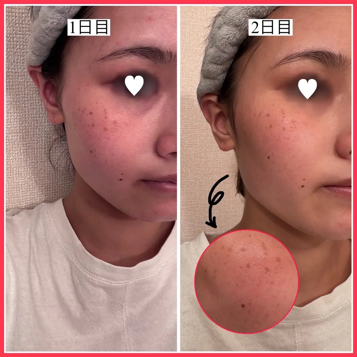 を使ったクチコミ（2枚目）