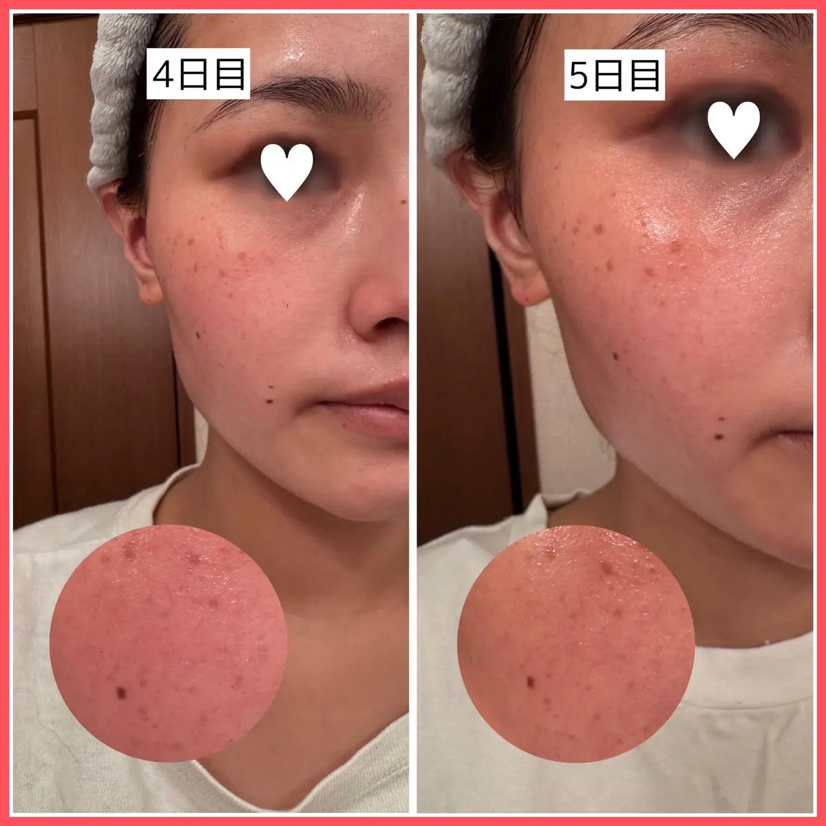 AZケア トナーパッド/VT/トナーパッドを使ったクチコミ（3枚目）