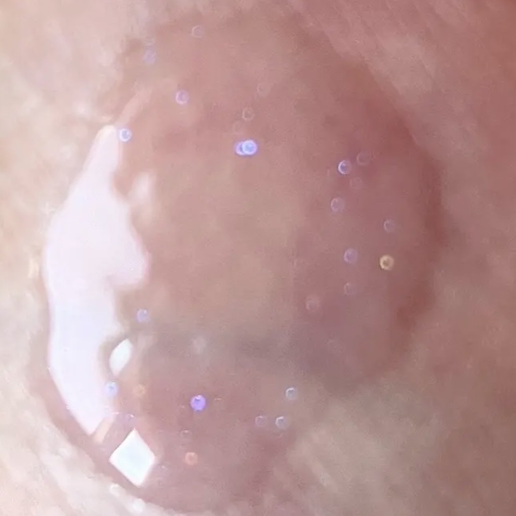 ガラスプランパー/CipiCipi/リッププランパーを使ったクチコミ（3枚目）