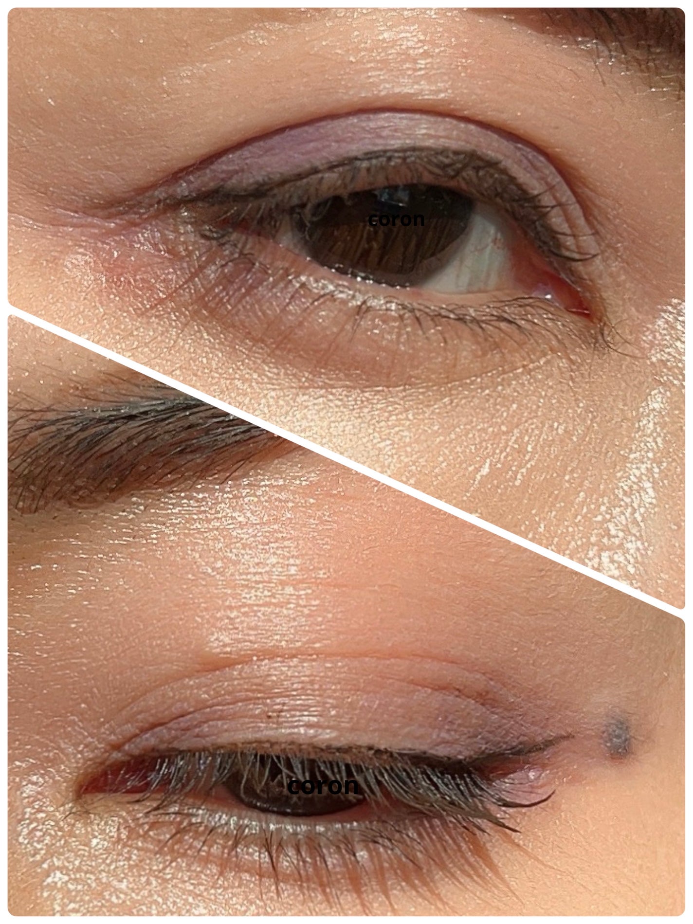 ããŒãã§ã¯ããšã¯ã¹ãã³ã·ã§ã³ ãã¹ã«ã©/D-UP/ãã¹ã«ã©ã䜿ã£ãã¯ãã³ãïŒ2æç®ïŒ