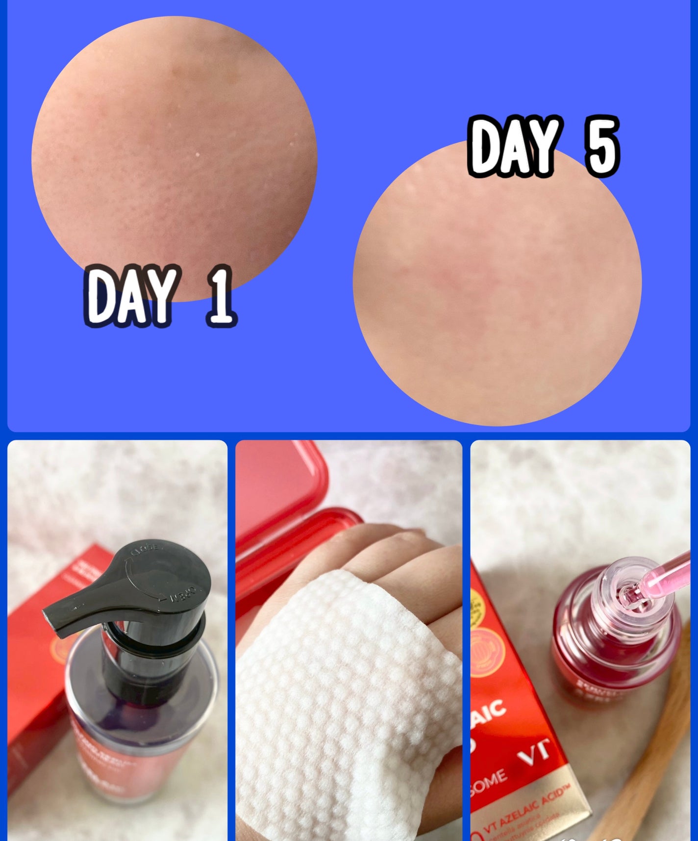 A1カーミング アンプル/VT/美容液を使ったクチコミ(5枚目)