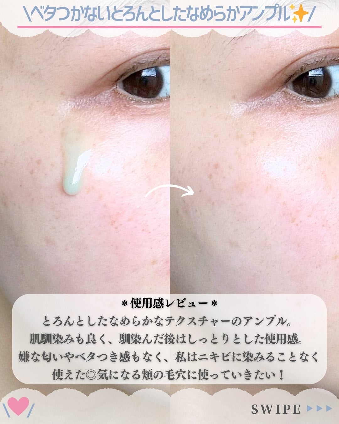 ReDRNエクソソームアンプル/Dr.nineteen/美容液を使ったクチコミ(5枚目)