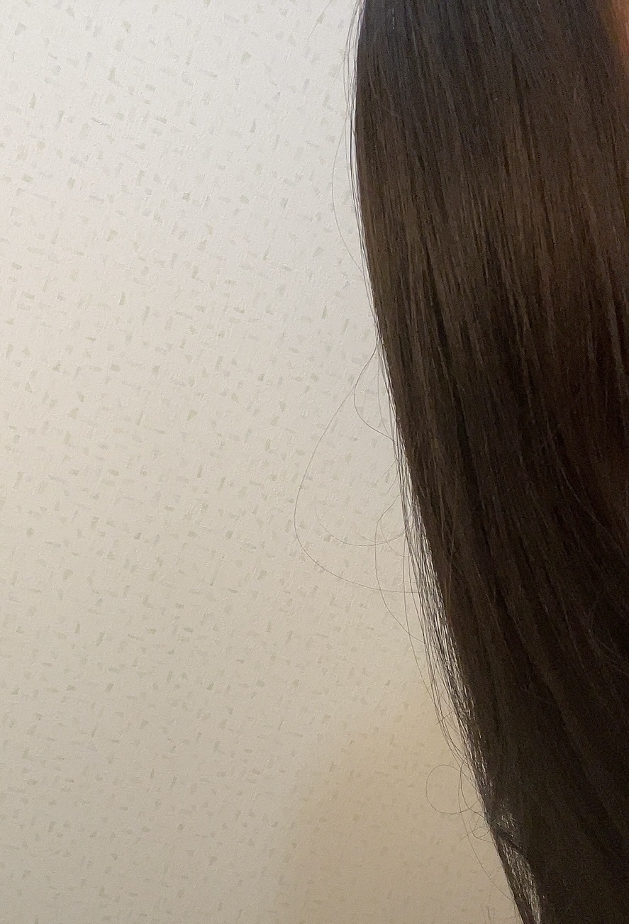 グローターン 100ml/リリーイブ/頭皮ローションを使ったクチコミ（2枚目）