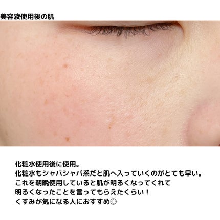 ガラク ナイアシン 3.0 エッセンス/manyo/美容液を使ったクチコミ(5枚目)