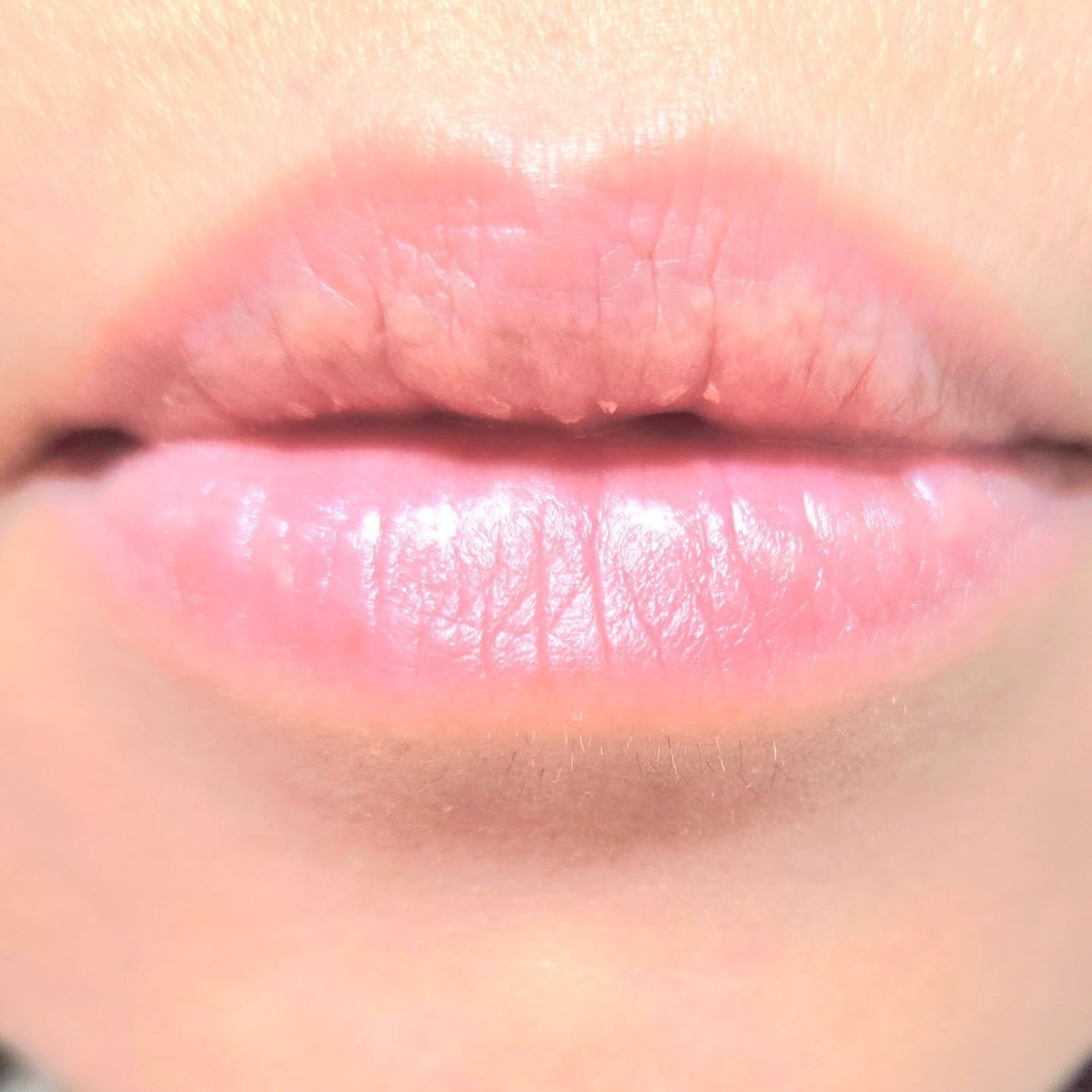 デイニードルリップ/CHOOSY/リップ美容液を使ったクチコミ(7枚目)