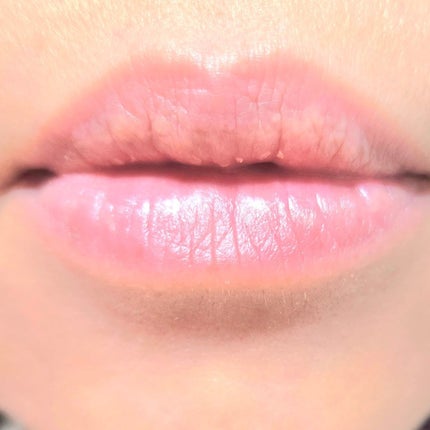 デイニードルリップ/CHOOSY/リップ美容液を使ったクチコミ(7枚目)