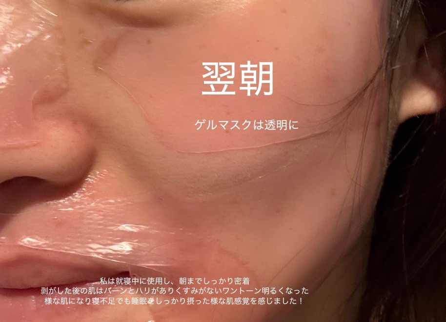 キングスベリービタナイトクリーム/hince/フェイスクリームを使ったクチコミ（3枚目）