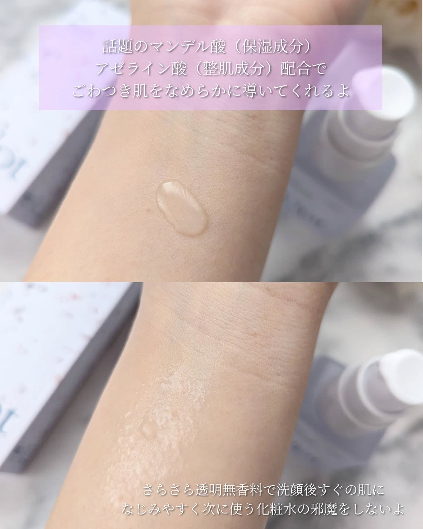 Upt MILD PEEL ESSENCE/Upt/ピーリングを使ったクチコミ（3枚目）