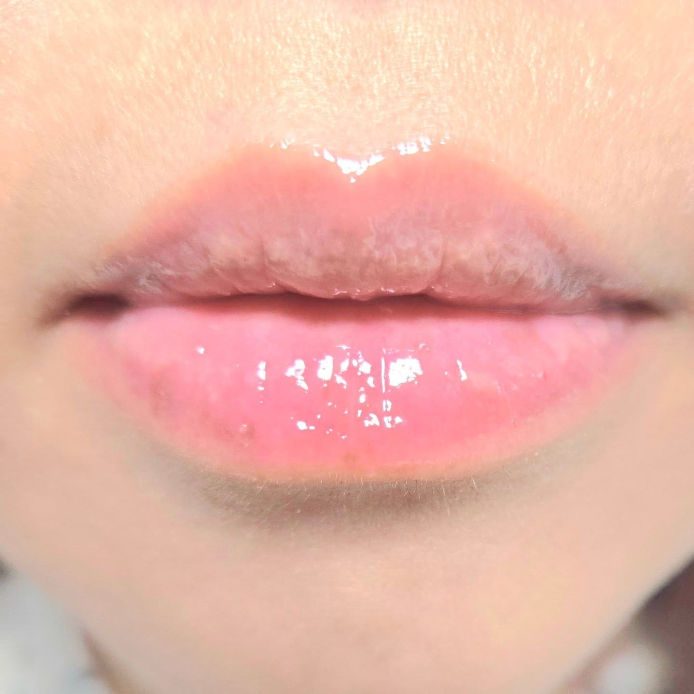 デイニードルリップ/CHOOSY/リップ美容液を使ったクチコミ(8枚目)