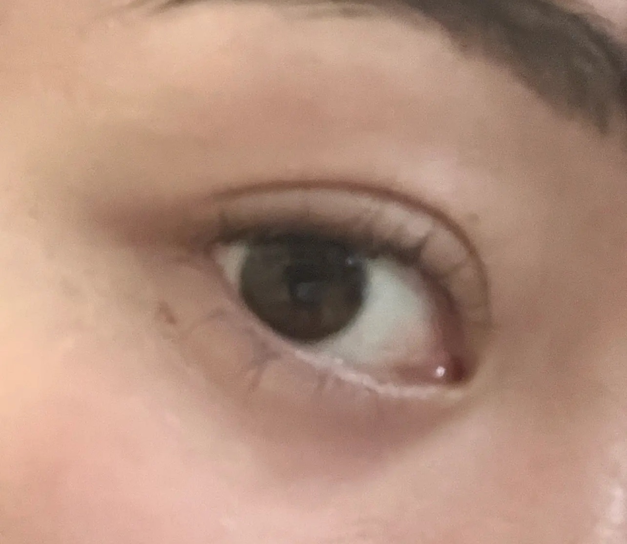 アイファルトアイバッククリーム/Dr.Melaxin/アイケア・アイクリームを使ったクチコミ（3枚目）