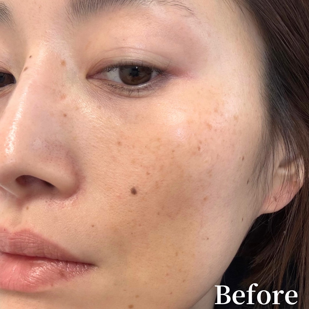 ディセンシア ホワイトF／L BBクリーム/DECENCIA/BBクリームを使ったクチコミ（3枚目）