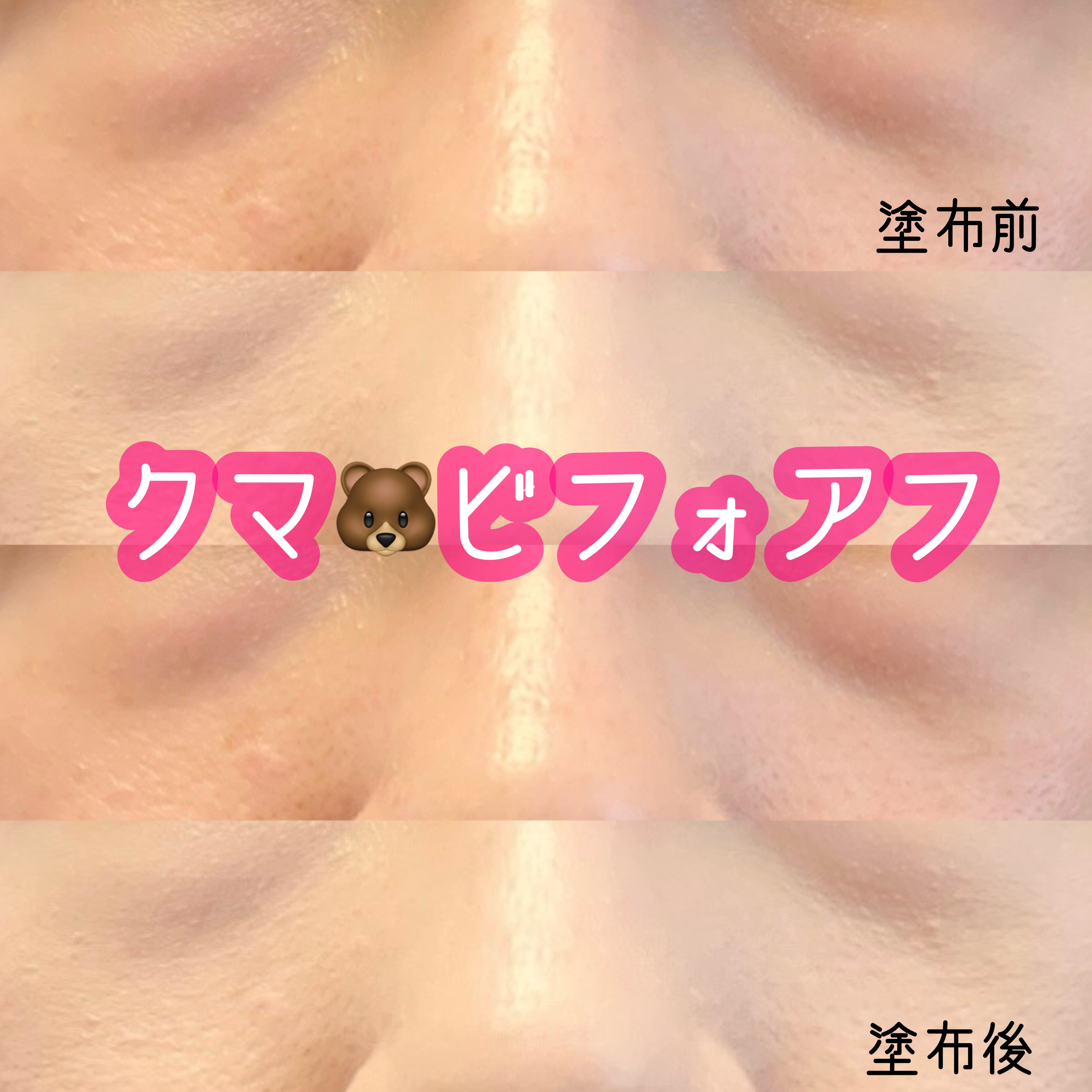 カバーリシャス アルティメット ホワイトクッション/BANILA CO/クッションファンデーションを使ったクチコミ（1枚目）