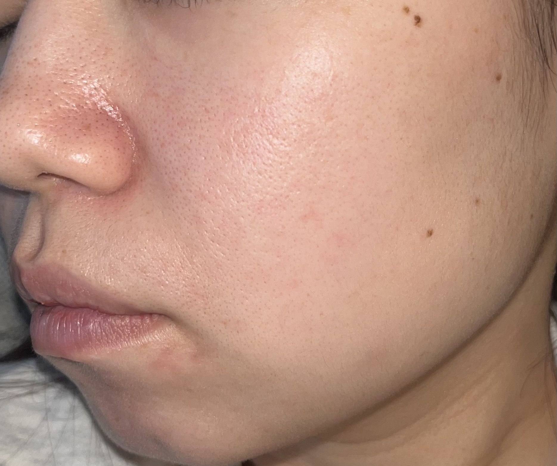 スキンパワー アドバンスト クリーム/SK-II/フェイスクリームを使ったクチコミ（3枚目）