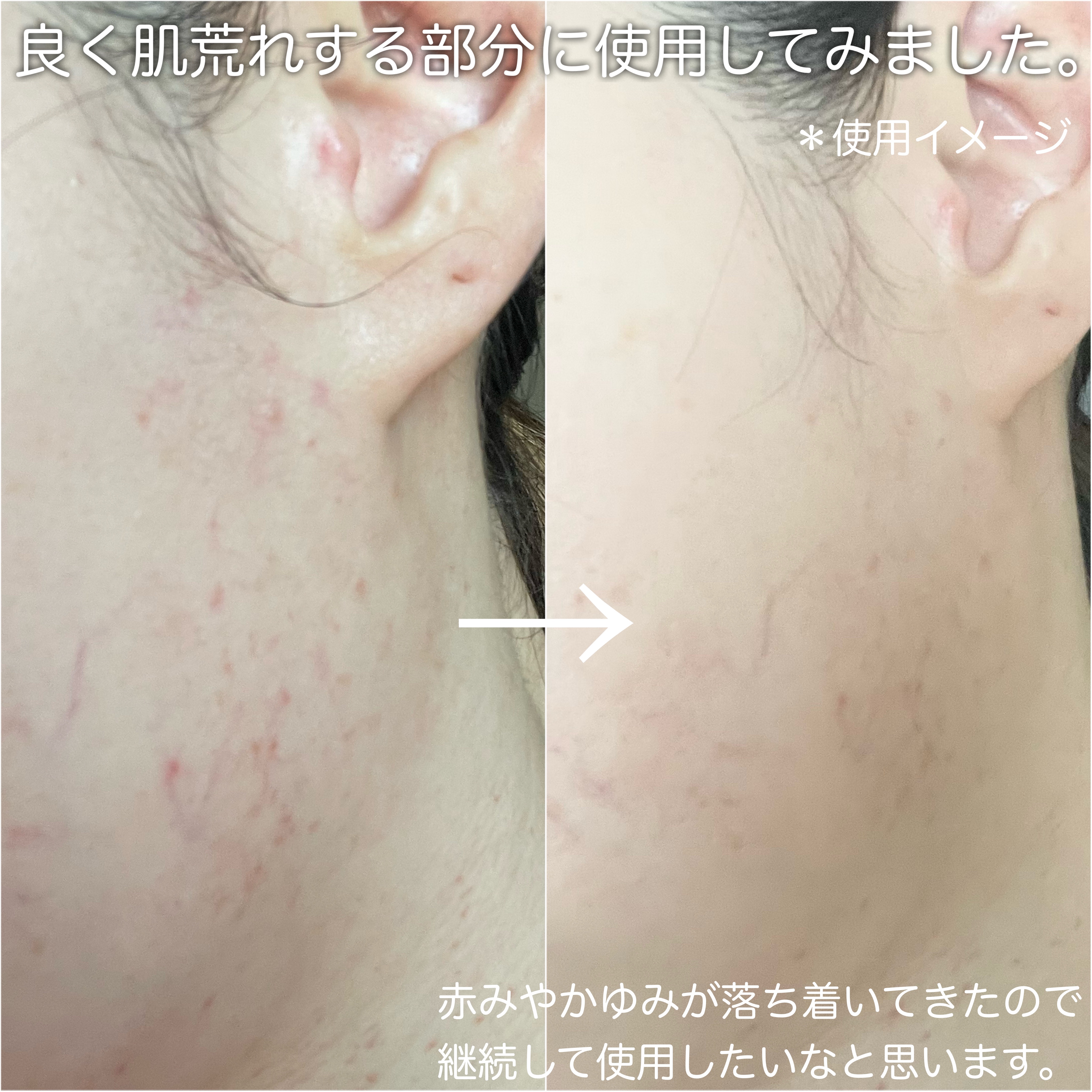 センテラスカー 軟膏 (オイントメント)/Mildlab/フェイスクリームを使ったクチコミ（3枚目）