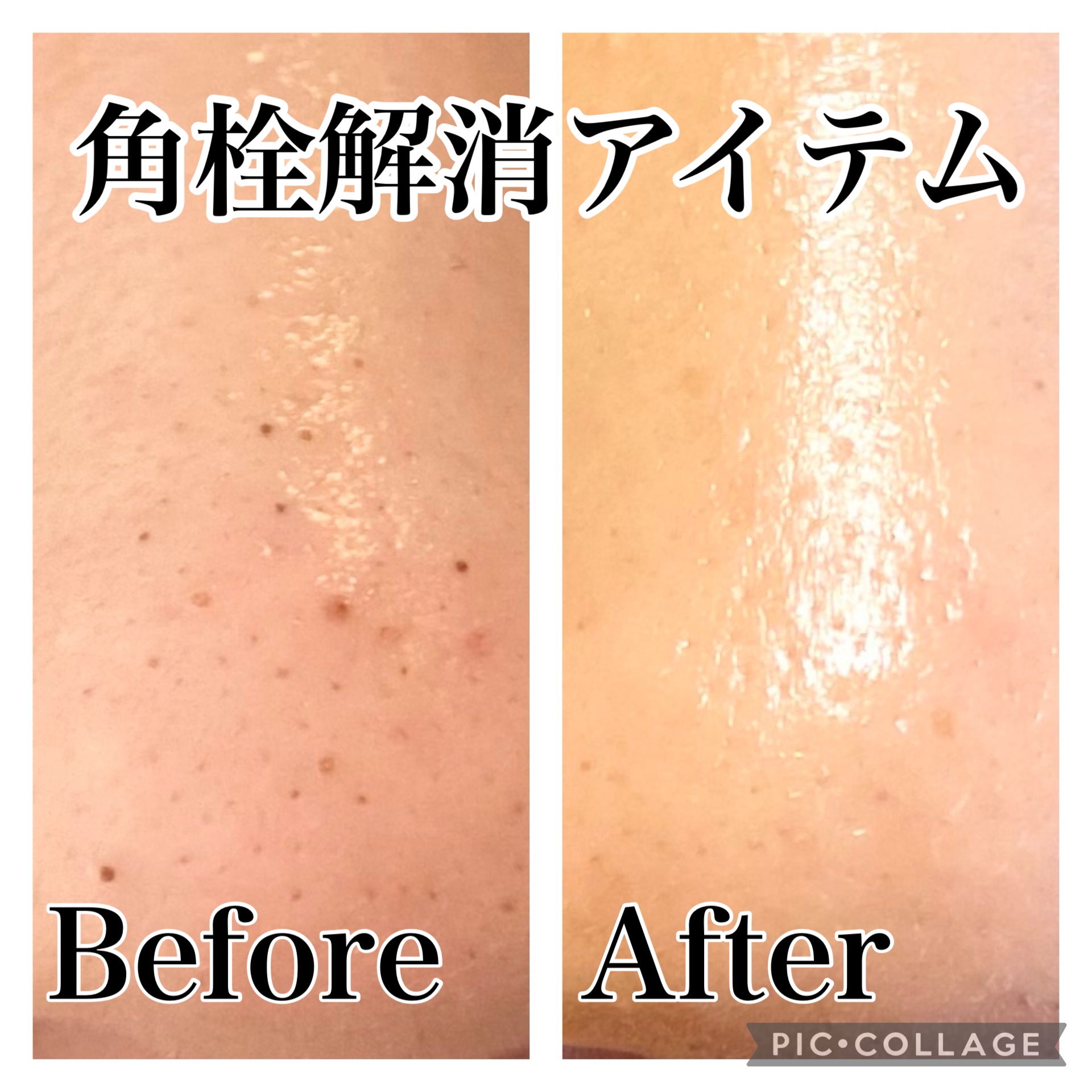 C25セラム ネオ/オバジ/美容液を使ったクチコミ（1枚目）