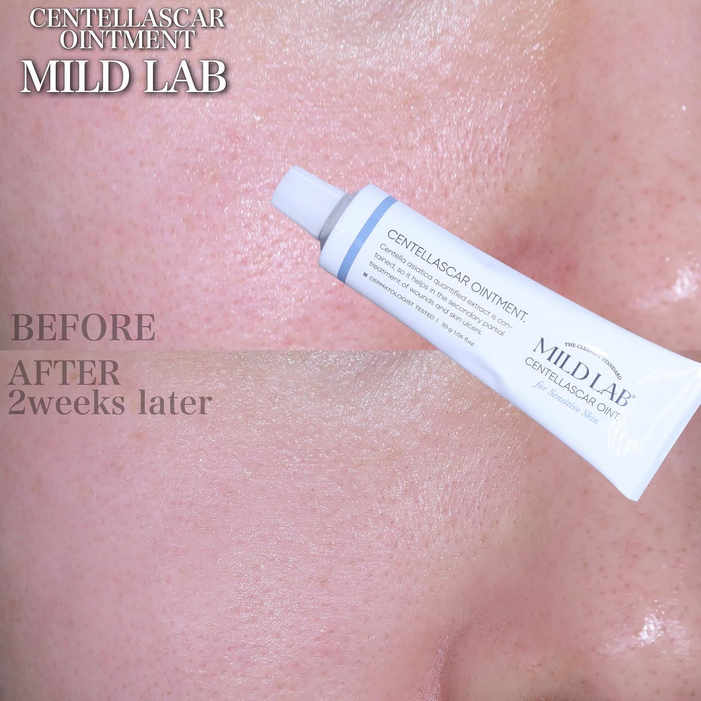 センテラスカー 軟膏 (オイントメント)/Mildlab/フェイスクリームを使ったクチコミ（1枚目）