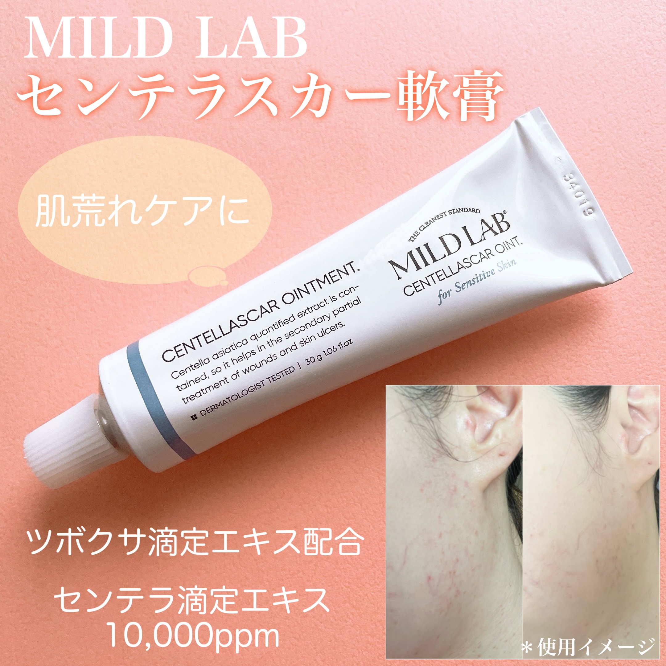 センテラスカー 軟膏 (オイントメント)/Mildlab/フェイスクリームを使ったクチコミ（1枚目）