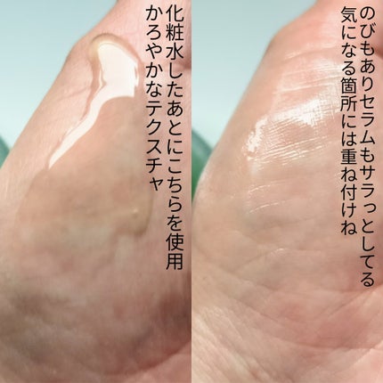 アゼライン酸15 インテンスカーミングセラム/Anua/美容液を使ったクチコミ(3枚目)