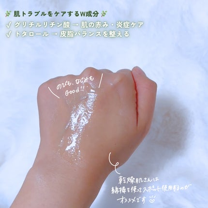 アゼライン酸15 インテンスカーミングセラム/Anua/美容液を使ったクチコミ(4枚目)