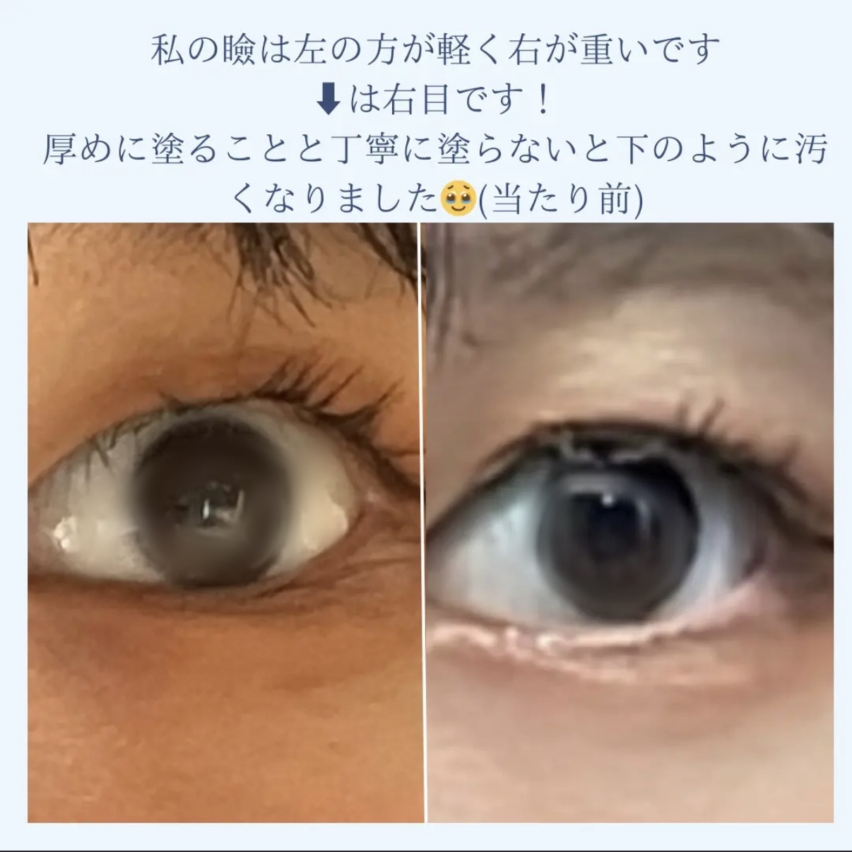 TWOOLダブルアイリッドハイブリットフィルム/SHOBIDO/二重まぶた用アイテムを使ったクチコミ（3枚目）